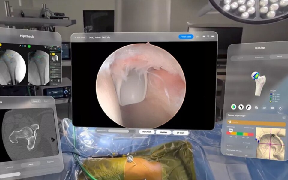 Apple Vision Pro Used in First Stryker Surgery at Duke