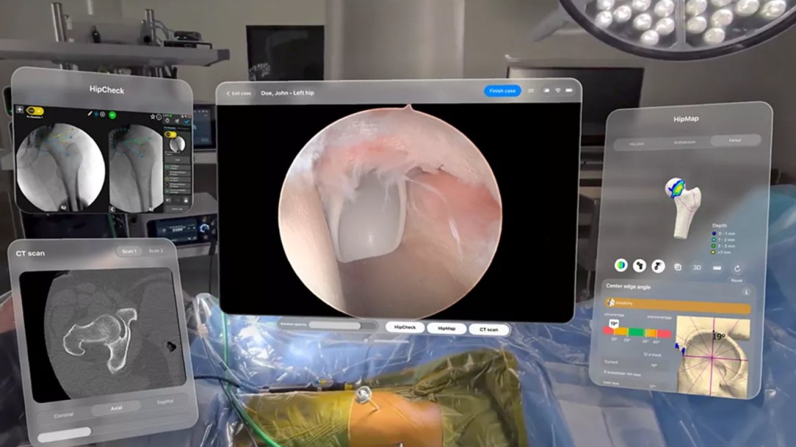 Apple Vision Pro Used in First Stryker Surgery at Duke - Apple Vision Pro surgery